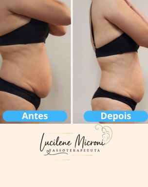 Ambiente relaxante para massoterapia em Várzea Paulista